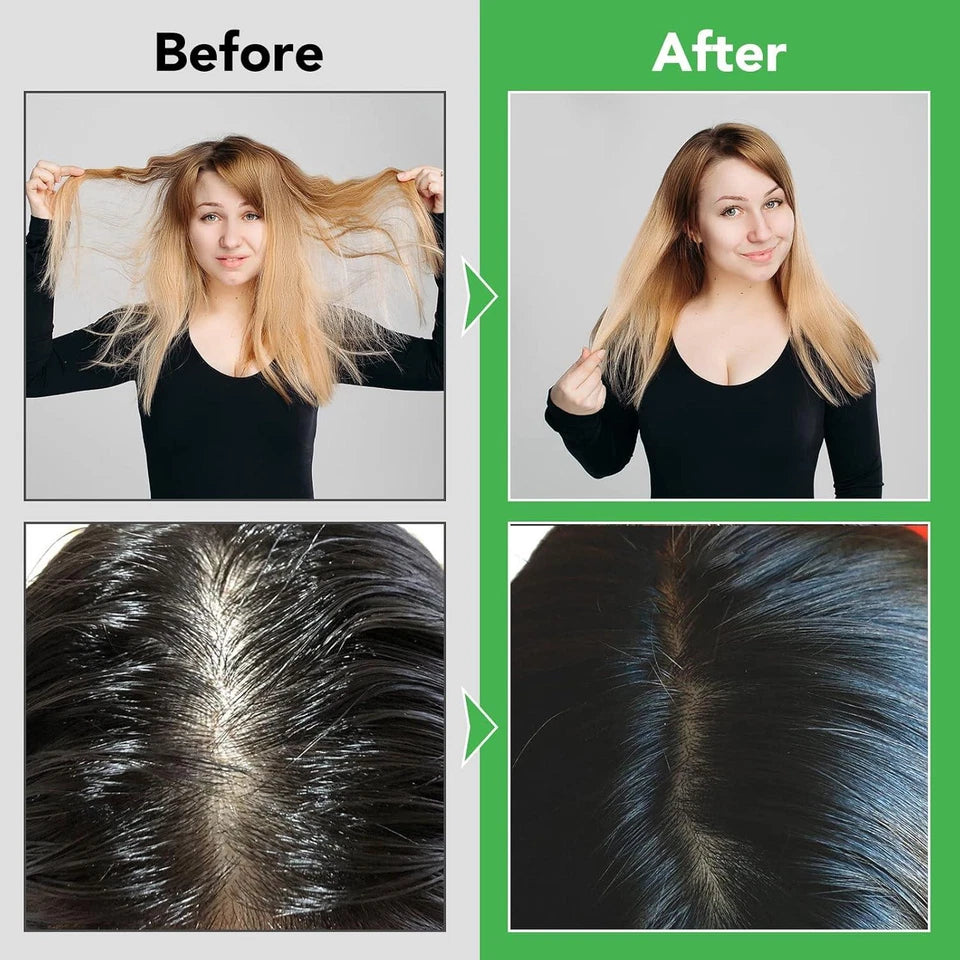 Rosemary Essential Oil Hair Growth Strengthening Hair & Skin Care Treatment 60ml