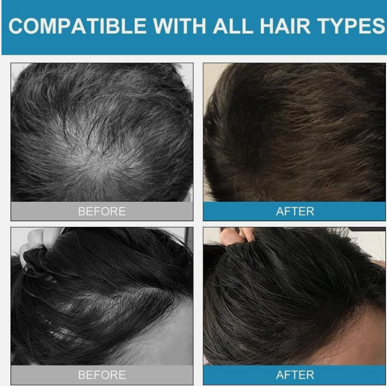 Keratin Hair Fibres Spray – Dark Brown, Instant Thickening for Men & Women