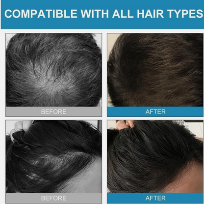 Keratin Hair Fibres Spray – Dark Brown, Instant Thickening for Men & Women