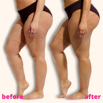Skinny Tan Dark Mousse 150ml – Natural-Looking Fake Tan, Coconut & Vanilla
