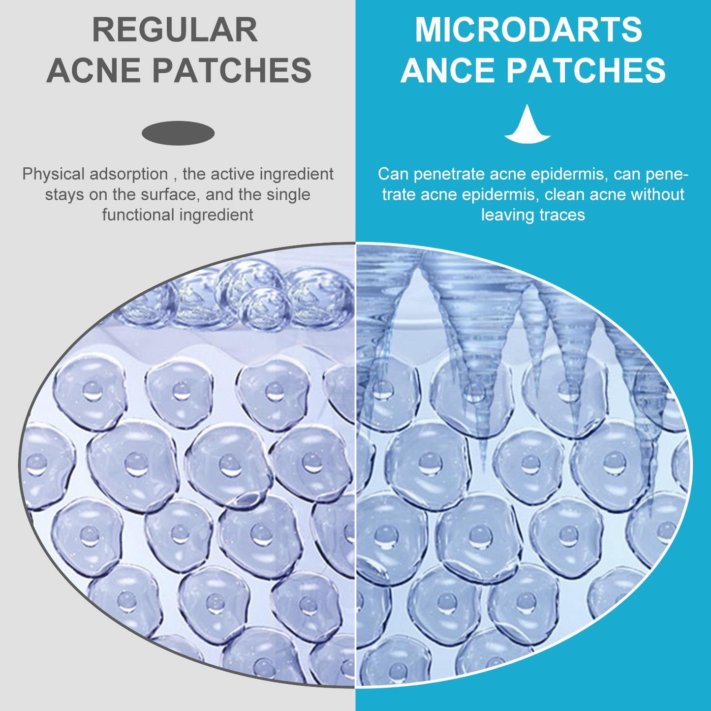 MICRO DARTS ACNE PATCH