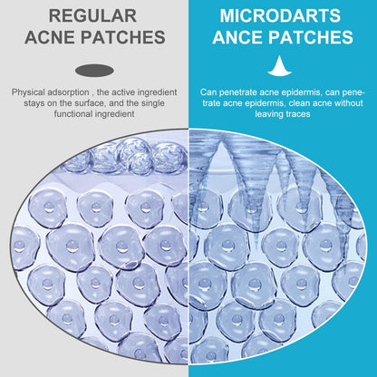 MICRO DARTS ACNE PATCH